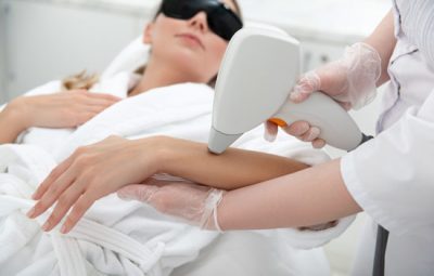 laser-hair-removal-service-e1698438994608